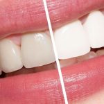 Cum poti avea dintii mai albi